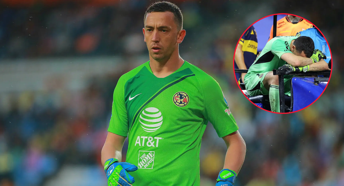 Agustín Marchesín sufrió una escalofriante lesión con Boca Juniors durante la Copa Libertadores