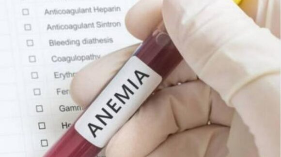 Anemia afecta a más de 8% de niños en edad prescolar en México