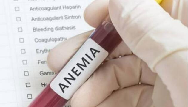 Anemia afecta a más de 8% de niños en edad prescolar en México