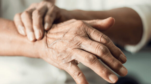 Día Mundial del Parkinson: Conoce los síntomas, tratamiento y cuántas personas lo padecen en México