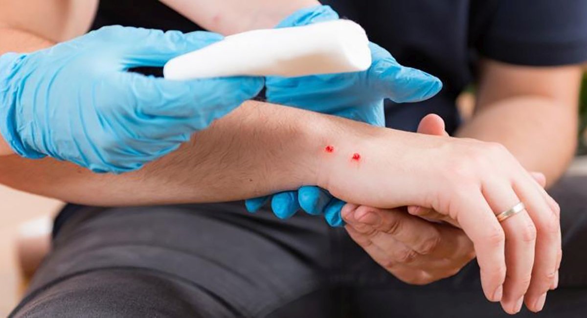 Secretaría de Salud en Sonora exhorta a prevenir mordeduras de serpiente