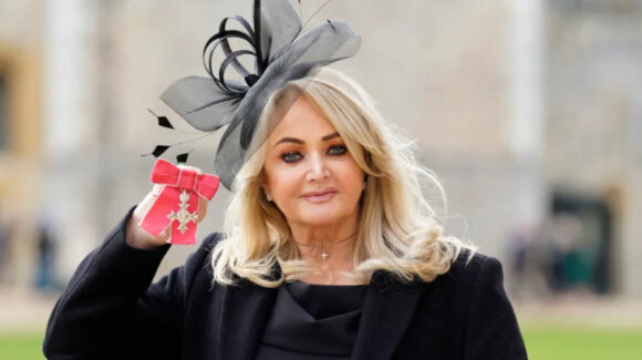Bonnie Tyler, grave tras perforación intestinal: La cantante sufre infarto al ser inducida al coma