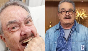Pedro Sola confirma fue hospitalizado de emergencia tras accidente casero; necesitó puntadas en el rostro
