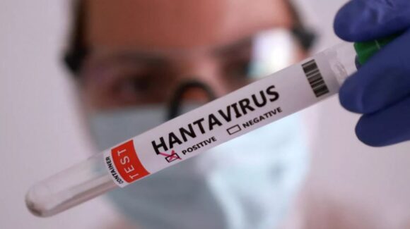 Hantavirus en crucero MV Hondius: OMS confirma 10 casos positivos y asegura que el RIESGO es bajo