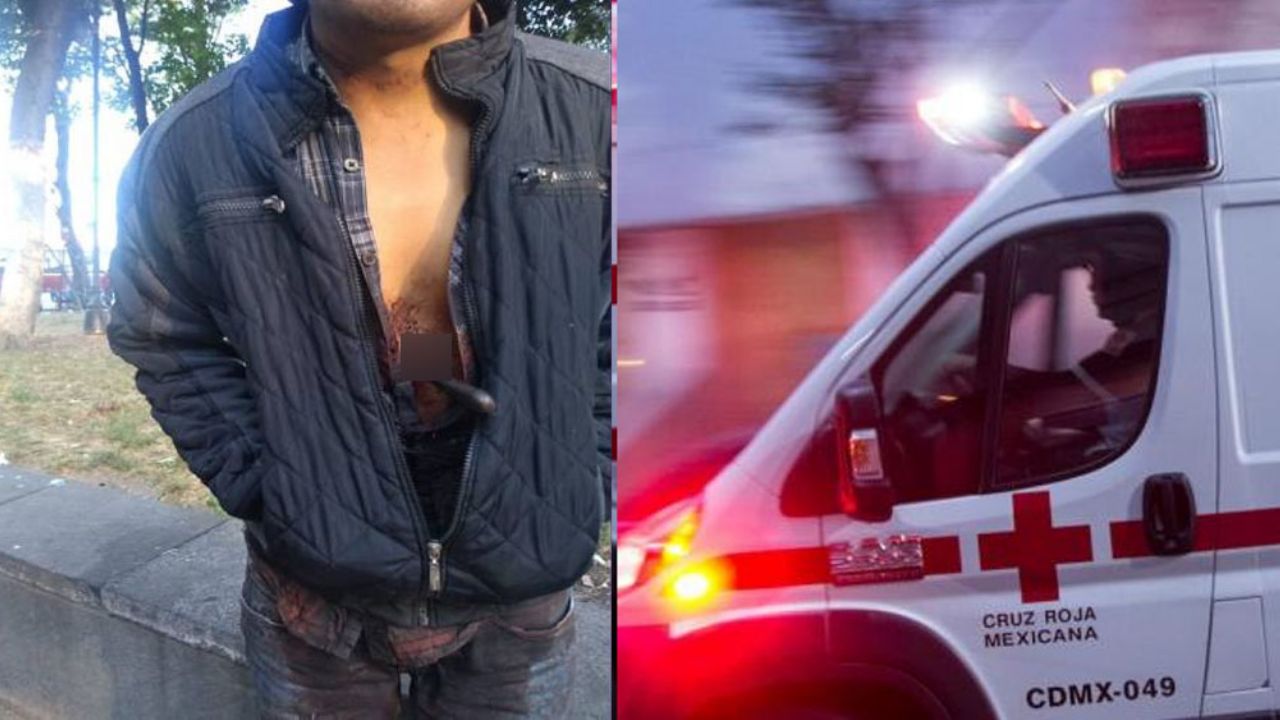 FOTO: Hombre camina por calles con cuchillo clavado y causa temor en CDMX