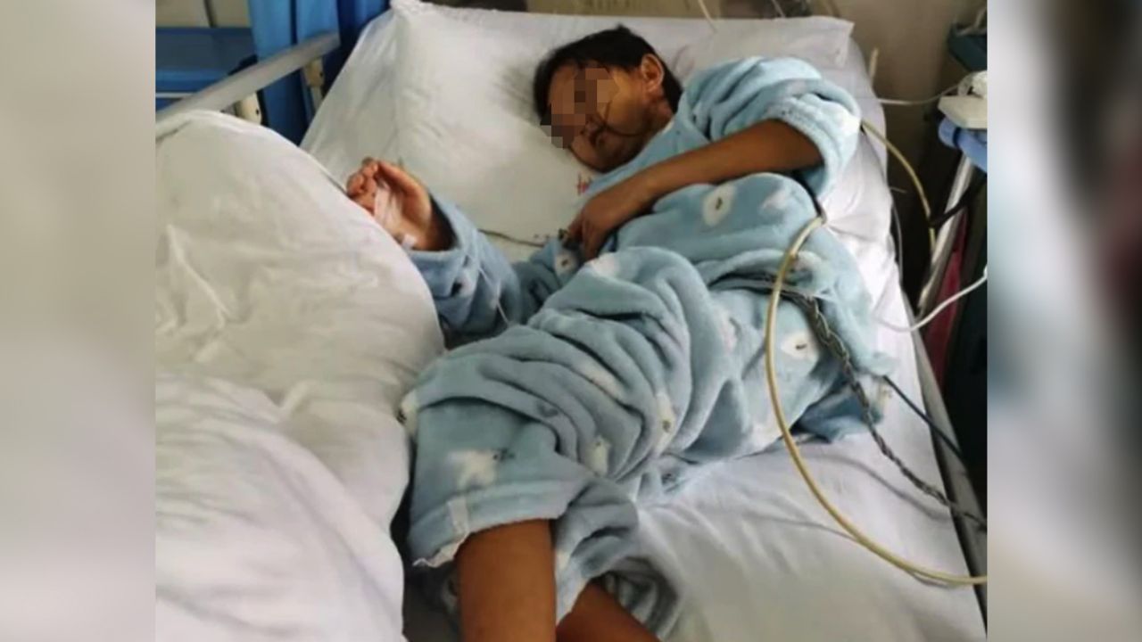 Muere joven que se alimentaba de puro arroz para cuidar a su hermano enfermo