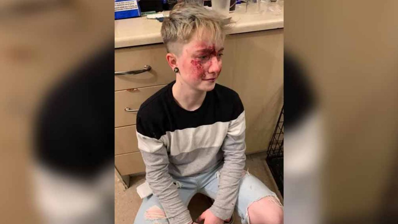Joven muestra su rostro ensangrentado tras ser víctima de ataque homofóbico
