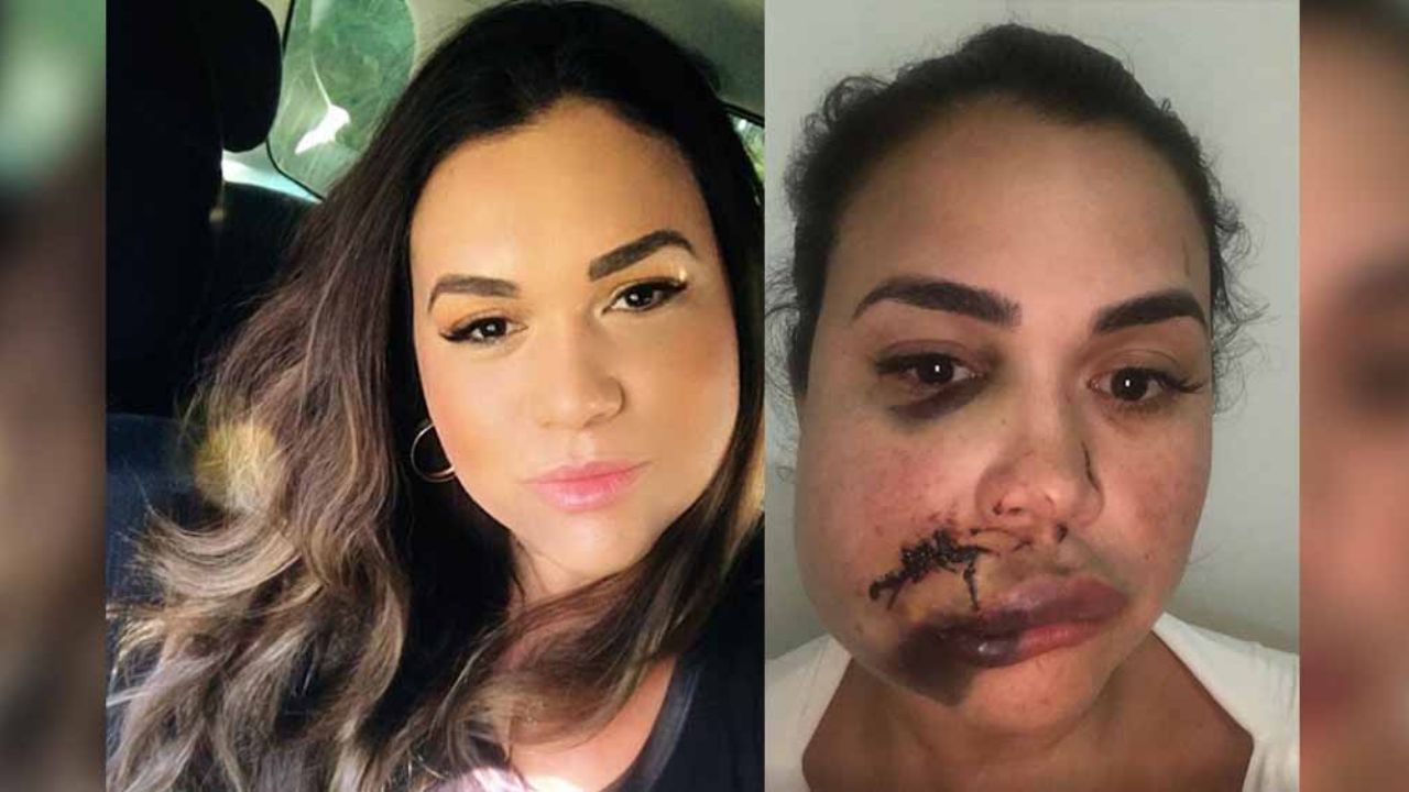 IMÁGENES FUERTES: Modelo destroza el rostro de ‘rival’ durante violenta pelea