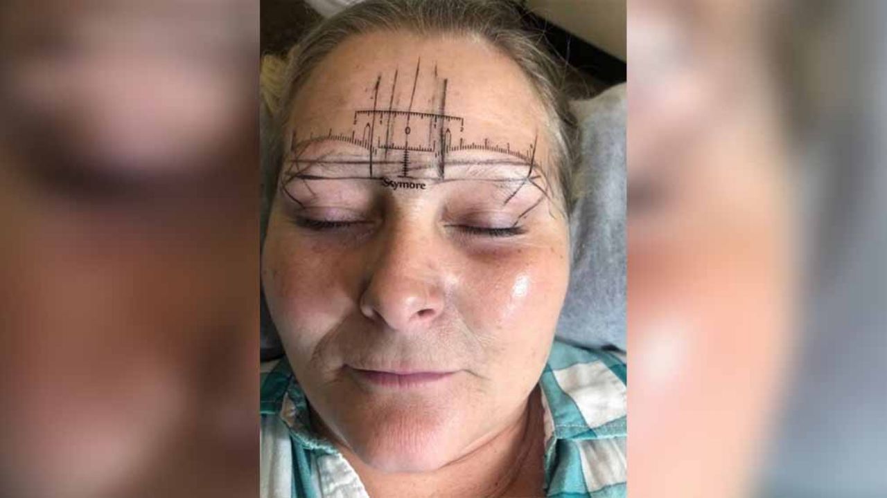 Microblading sale mal y mujer termina con “monstruosas” cejas ampolladas