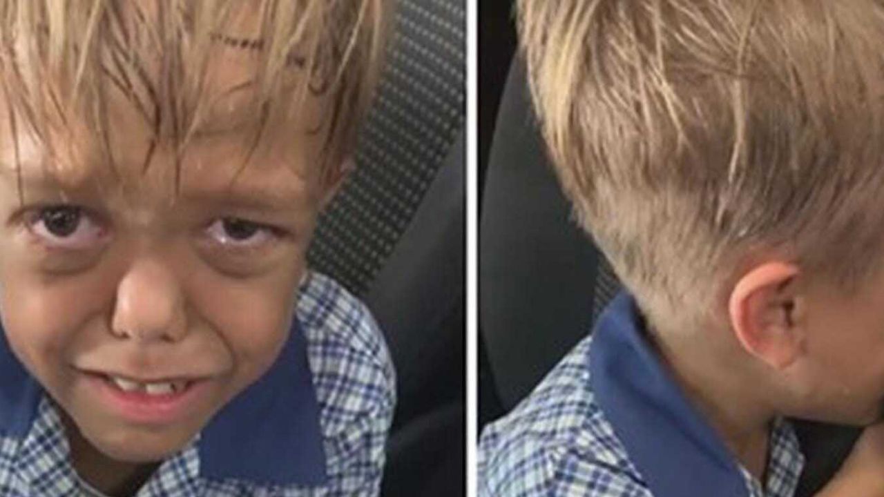 Quaden Bayles: Familia del pequeño rechaza viaje a Disneylandia