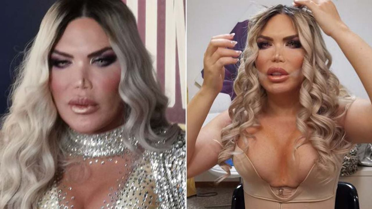 De ‘Ken’ a ‘Barbie’: Rodrigo Alves presume con orgullo sus nuevos senos