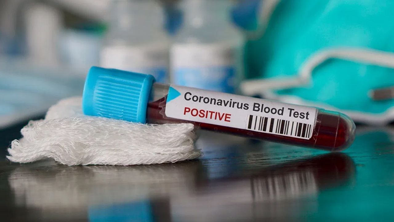 Coronavirus invade EU: Se confirma el noveno infectado en California
