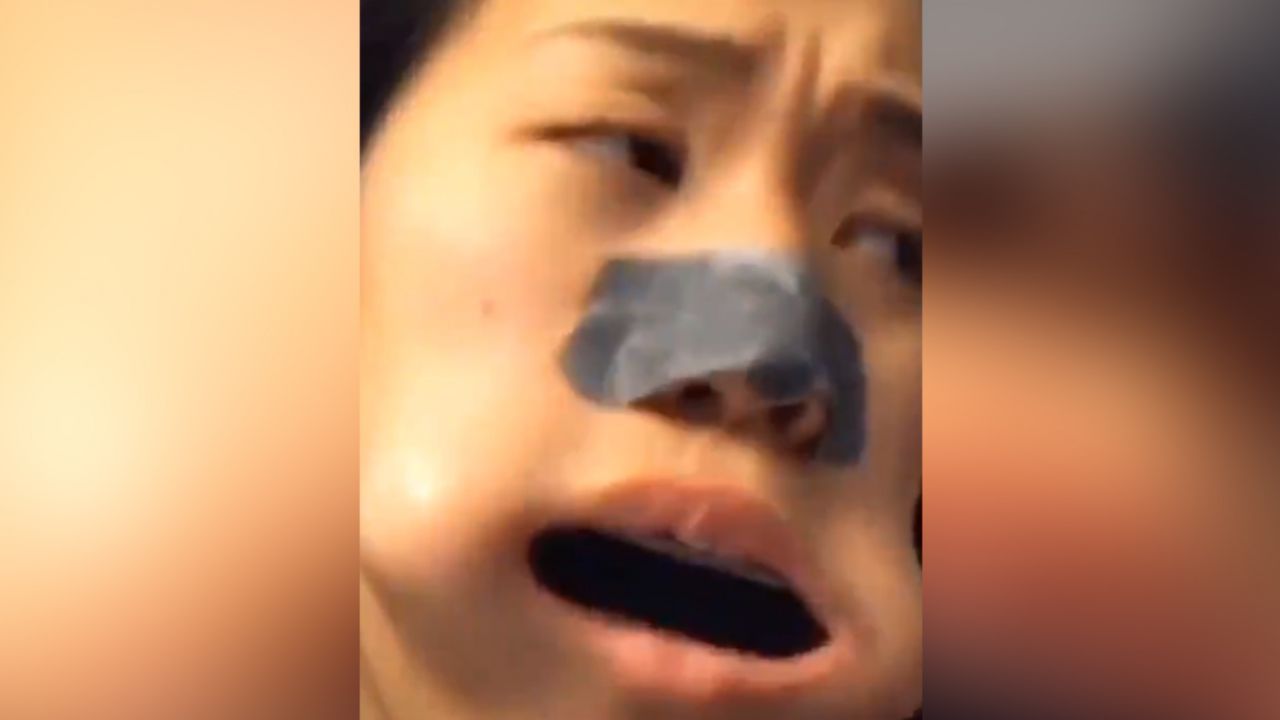 VIDEO: Joven introduce una armónica en su boca para Tik Tok y acaba mal