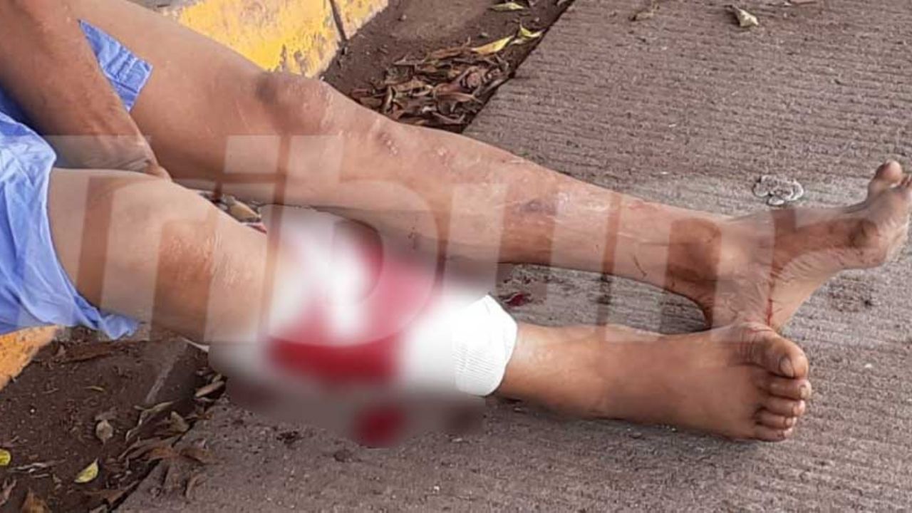 En bata y herido de una pierna, así intentó escapar un hombre de hospital