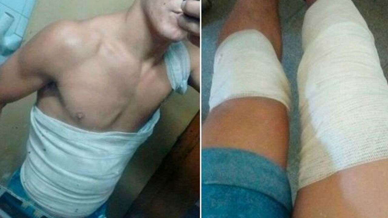 Joven despierta en llamas tras poner su teléfono en la cama mientras cargaba