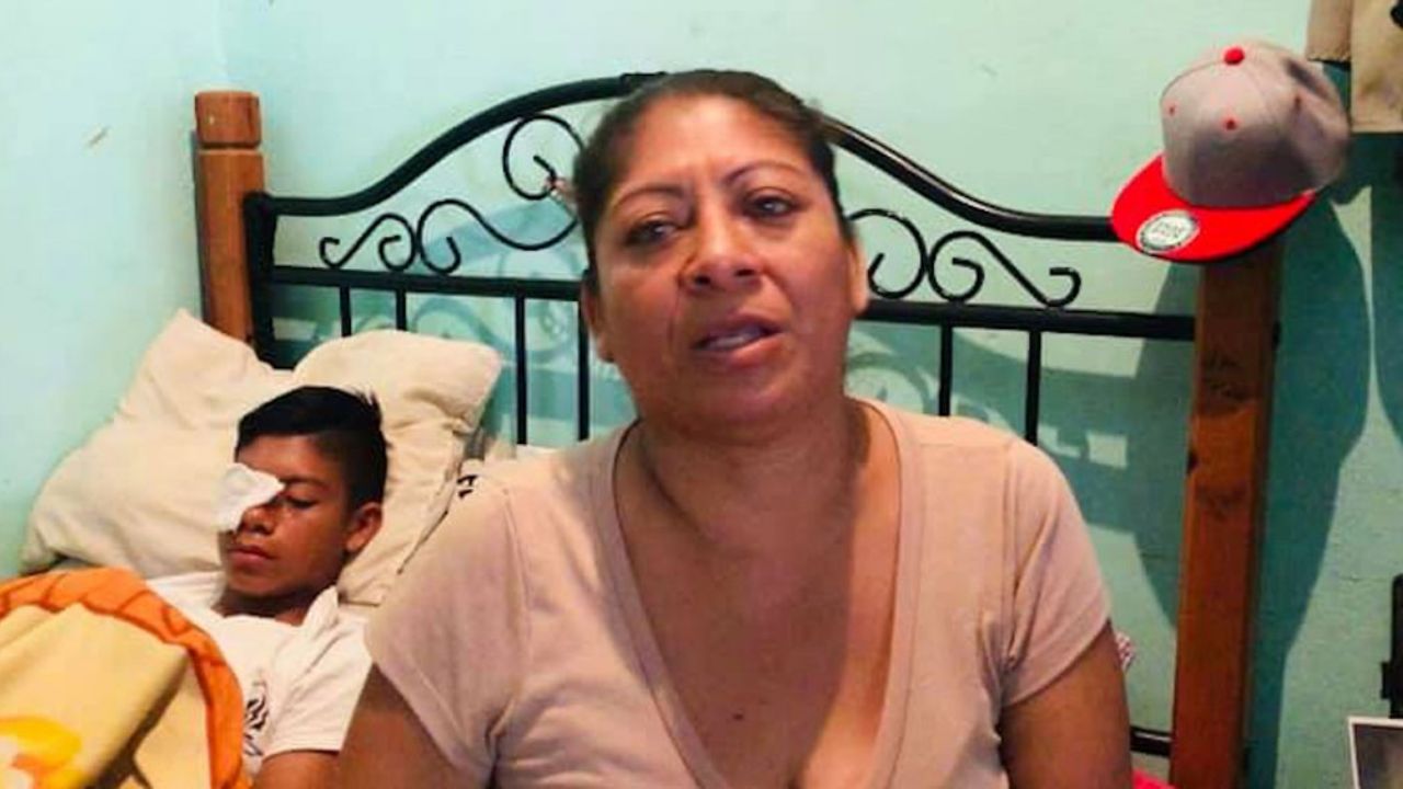 Detienen a menor que dejó ciego a un compañero de escuela con una pedrada