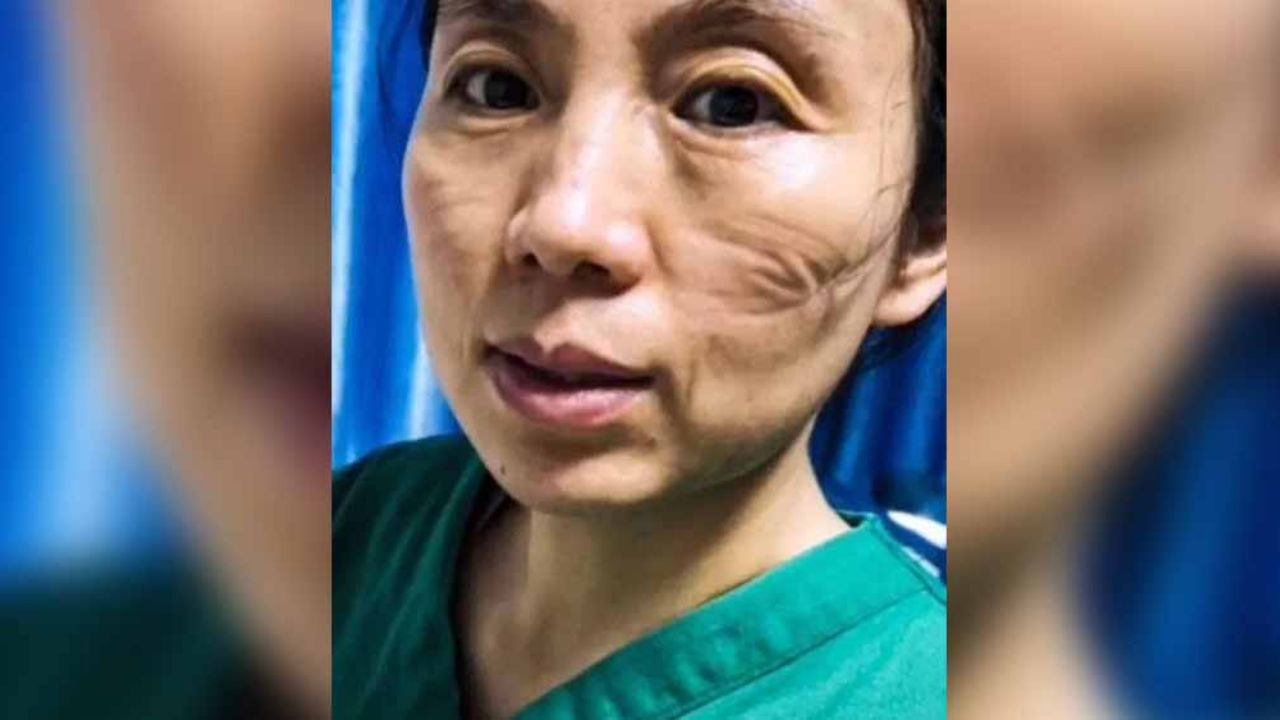 FOTOS: Las marcas de los médicos que combaten el coronavirus sin descanso