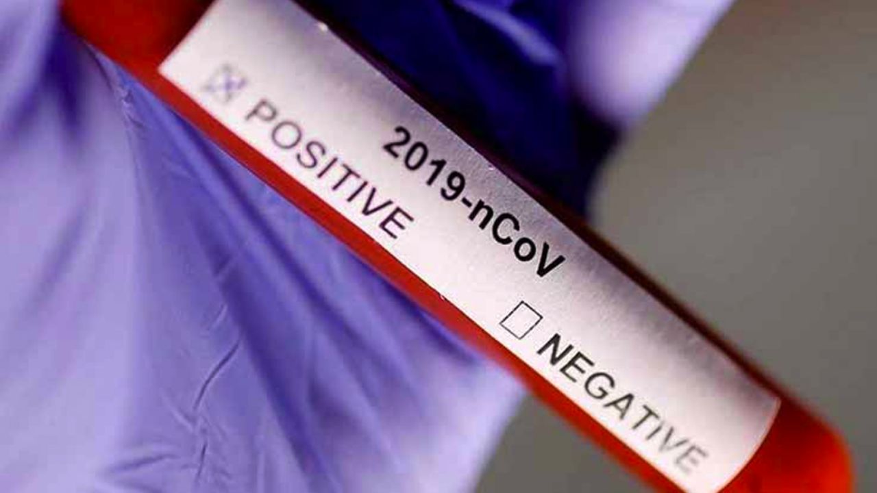 Francia confirma otros cinco casos de coronavirus; cuatro adultos y un niño