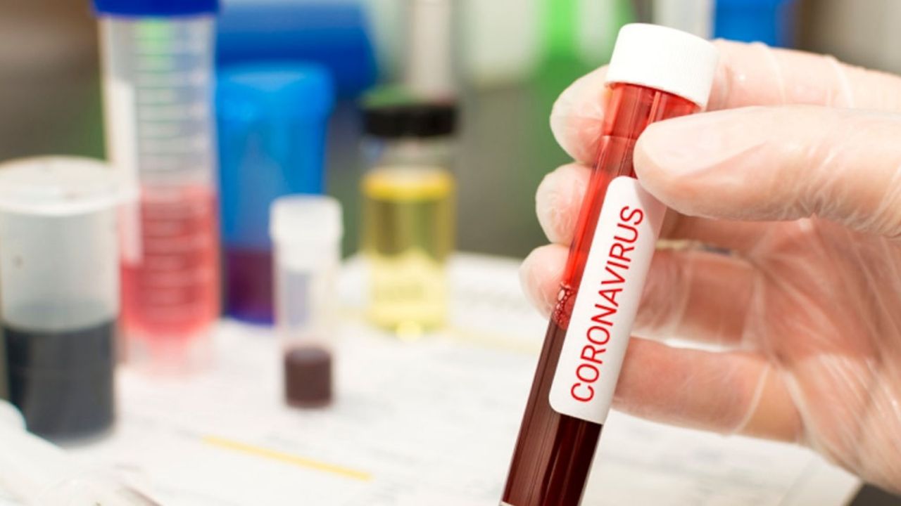 Detienen a mujer por fingir tener coronavirus para ser atendida de prisa