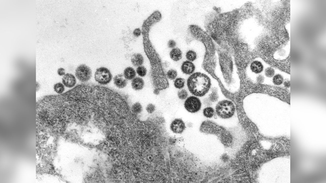 Fiebre de Lassa, la enfermedad que ha matado a 41 personas en Nigeria