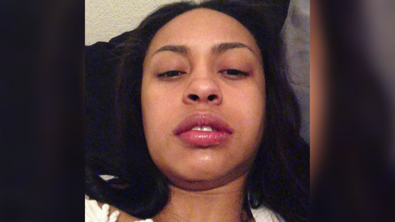 VIDEO: Stripper se fractura la quijada tras brutal caída desde un tubo