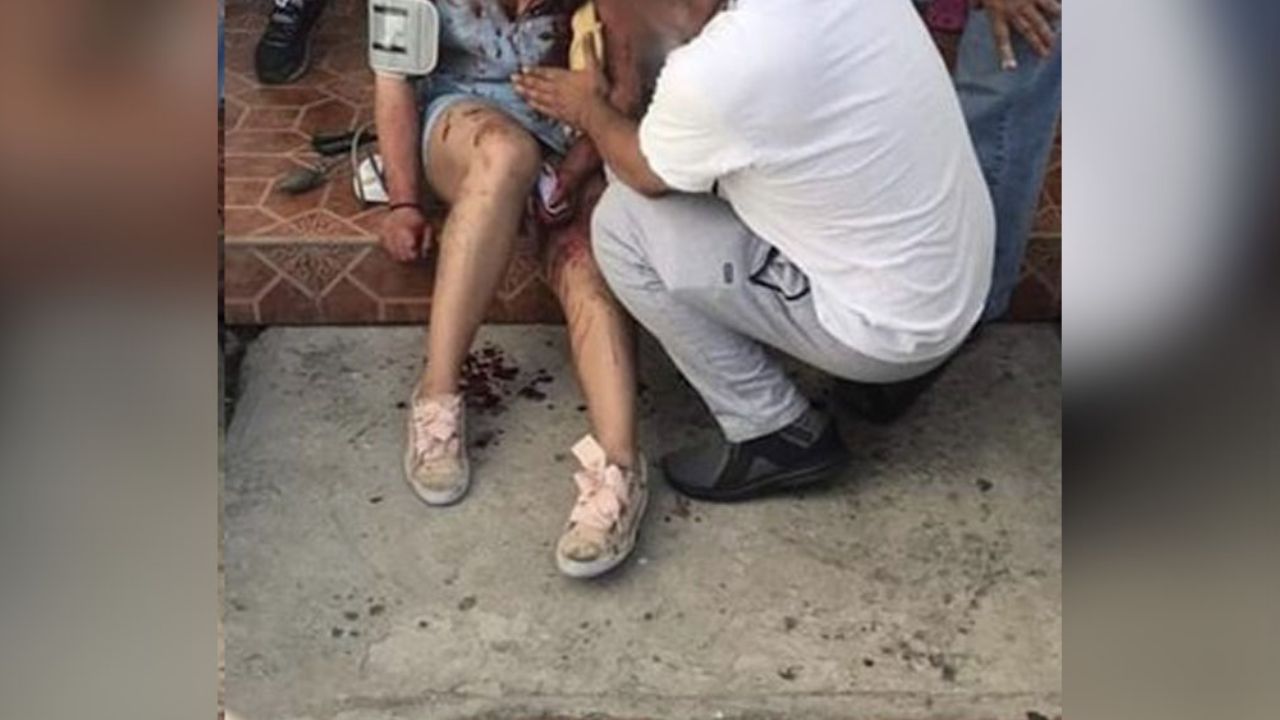Hombre apuñala a su exesposa frente a su hija en CDMX; vecinos lo apalearon