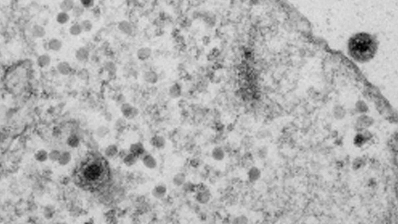 Detectan en Brasil el yaravirus, un nuevo, letal y misterioso virus