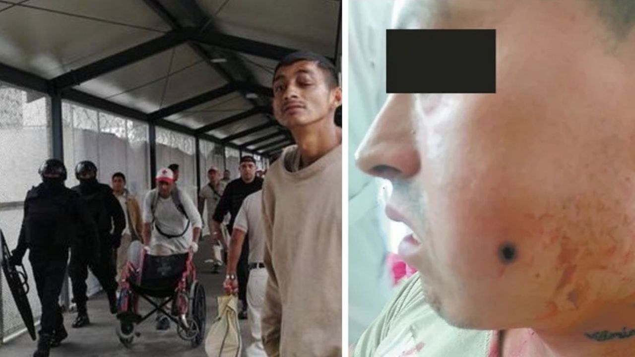 Balean con una “pluma pistola” a reo dentro del Reclusorio Oriente en CDMX