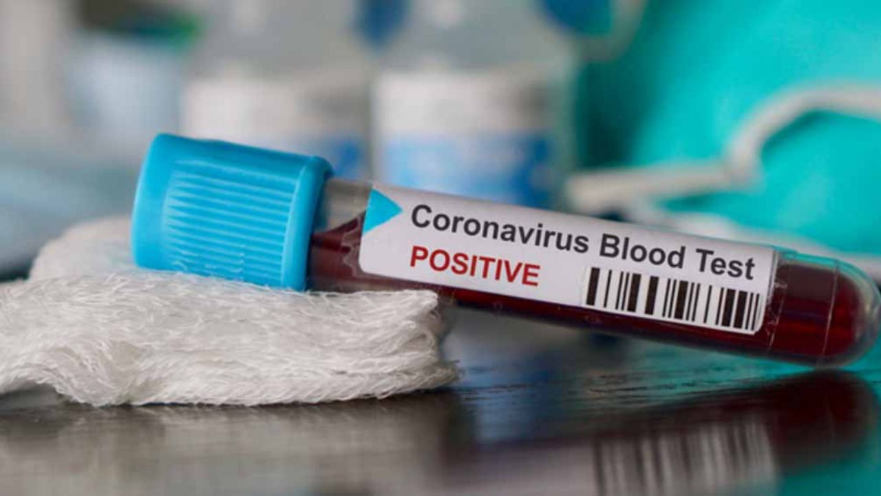 Médico jefe de hospital en Wuhan muere de coronavirus al combatir la infección