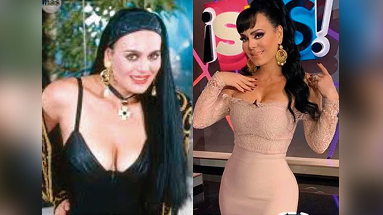 Desde bótox hasta la lipo: Ventilan todos los ‘arreglitos’ de Maribel Guardia