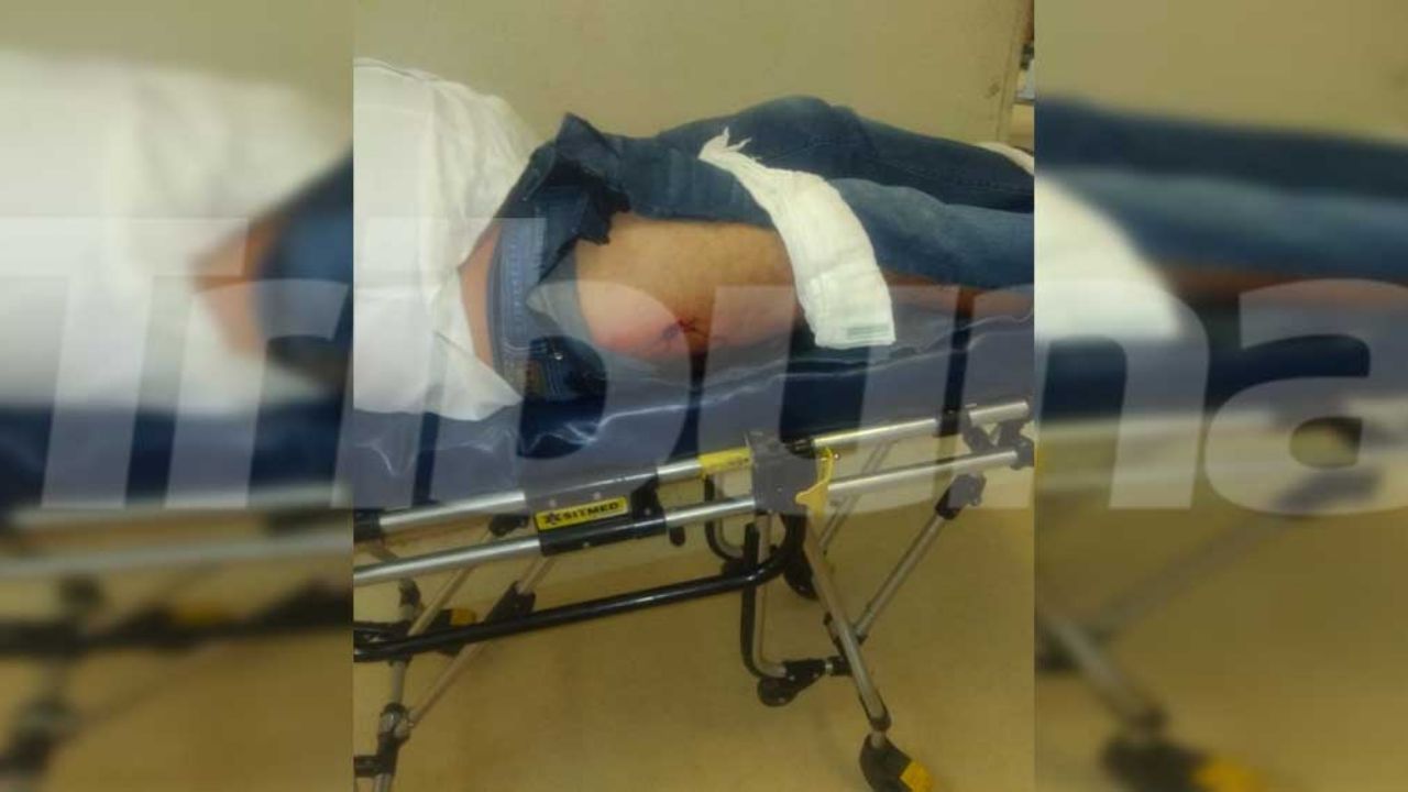 Fallece uno de los lesionados en ataque armado en la colonia Campestre