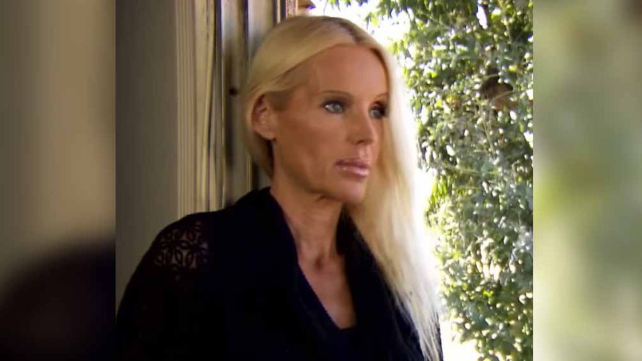 Actriz casi pierde el brazo por feroz pelea de sus perros; sufrió fracturas