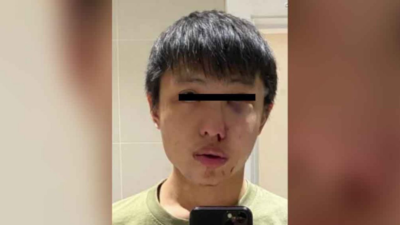 Tras paranoia por coronavirus, joven asiático es agredido por dos hombres