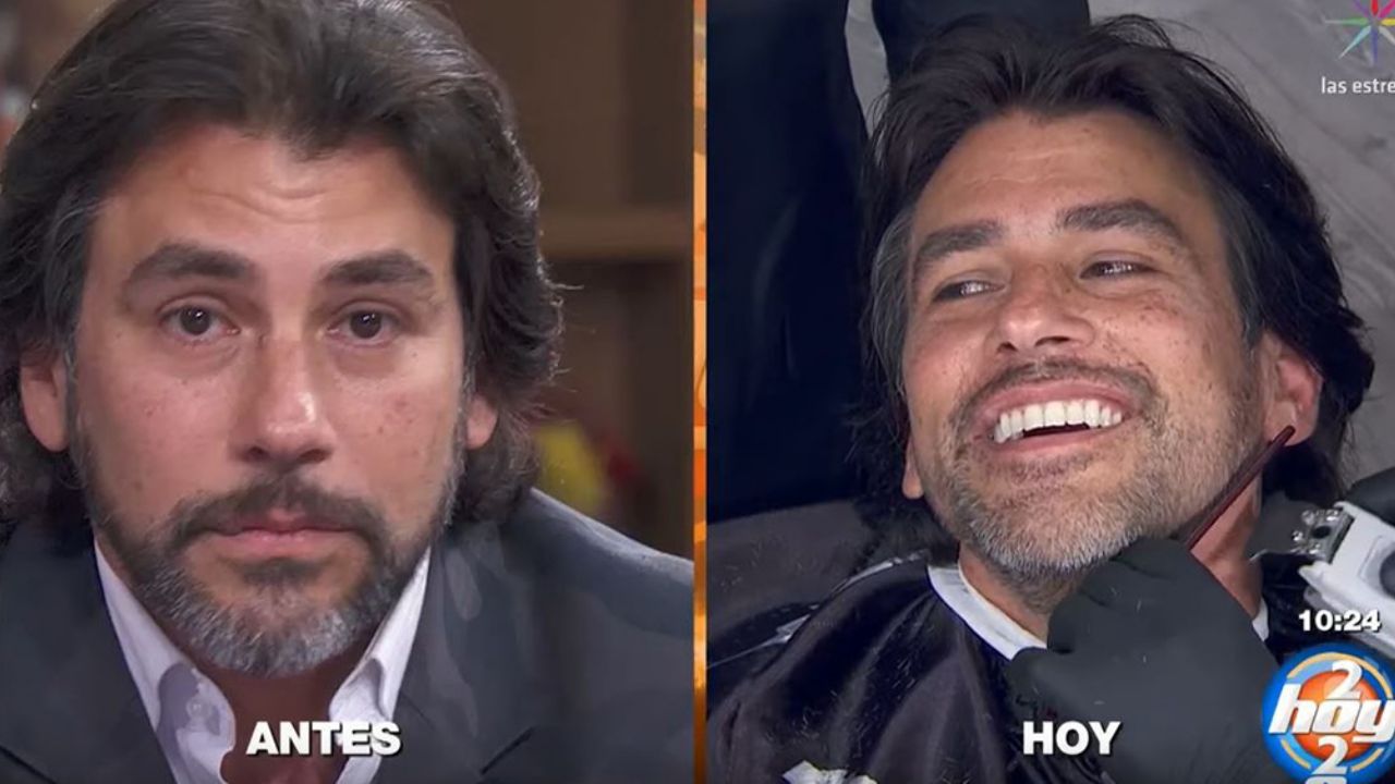 ¡Igualito al ‘Negro’! Barcelata llega a Televisa y ‘Hoy’ le hace drástico cambio de look