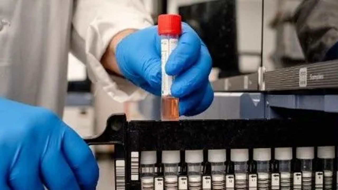 Coronavirus: Nuevo León confirma segundo caso de Covid-19; viajó a EU