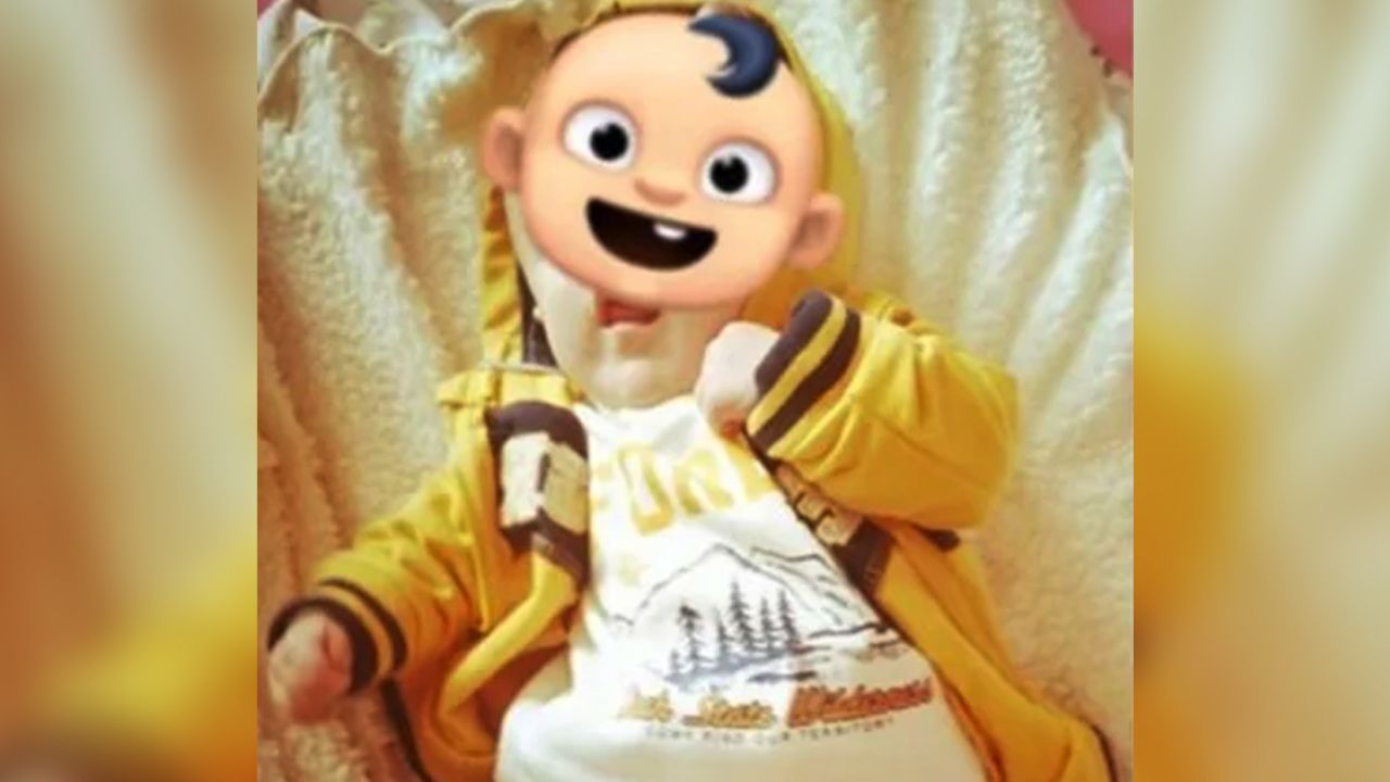 Bebé sin rostro le daban 4 horas de vida; hoy celebra 5 meses junto a su familia