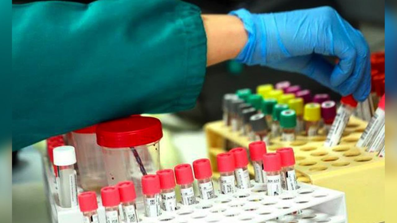 EU prueba vacunas en seres humanos para frenar el coronavirus