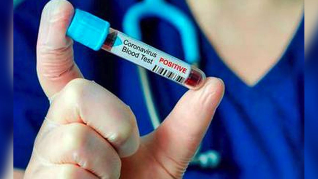 Coronavirus en México: Confirman primer caso en Chihuahua de Covid-19