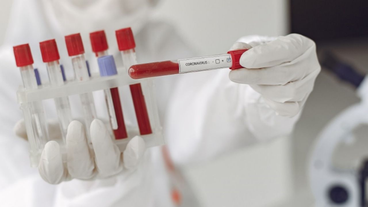 Confirman nuevo caso de coronavirus en Tamaulipas; ya son cuatro infectados