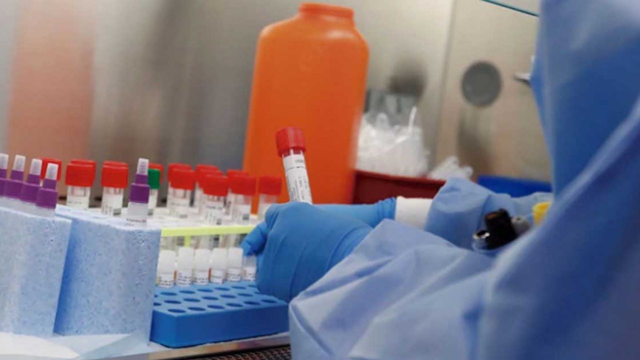 Coronavirus: Argentina registra primer caso de transmisión comunitaria