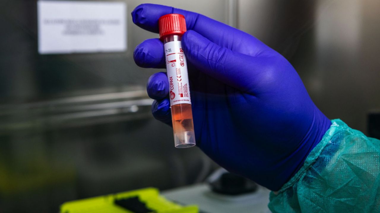 Coronavirus: Primer caso en Cajeme; es una mujer que estuvo en España y Dubái