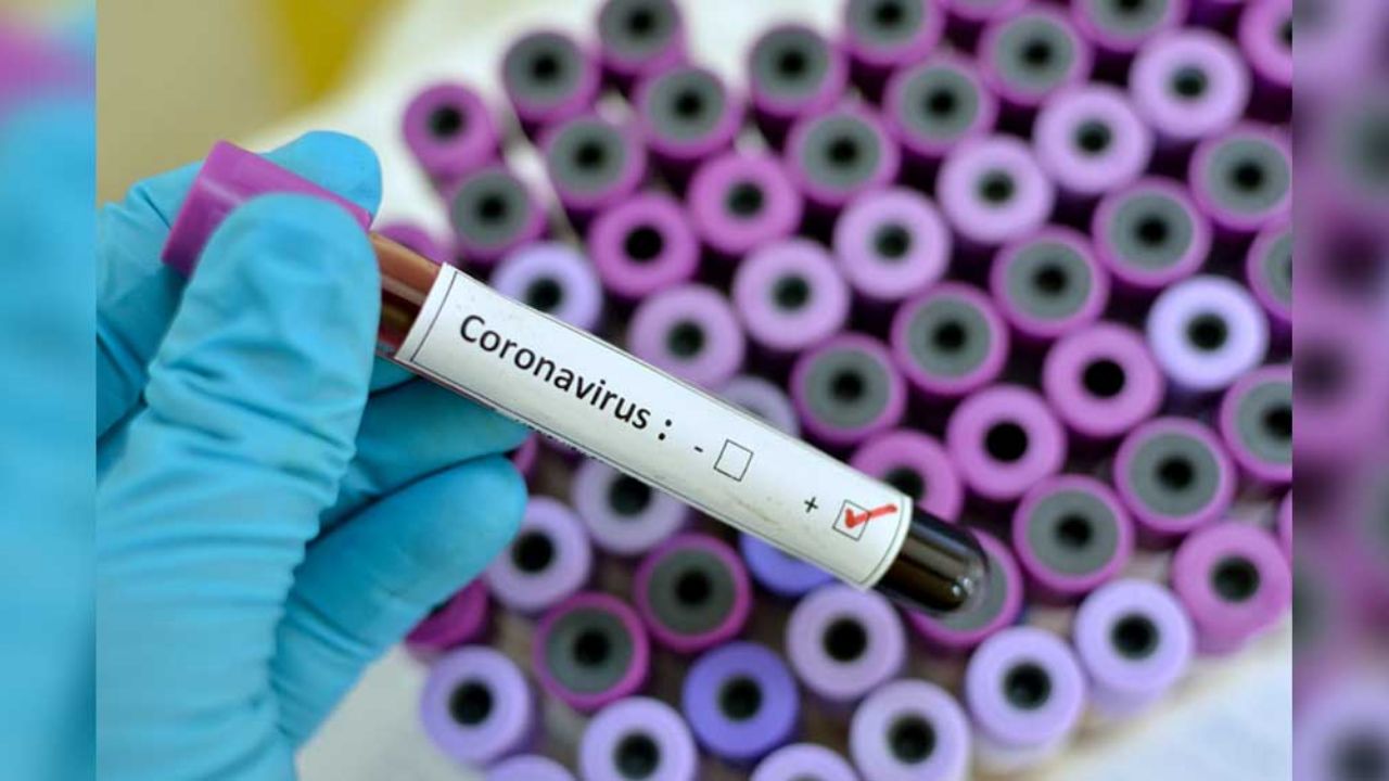 Joven podría ir a prisión por infectar de Covid-19 a 11 en fiesta; violó cuarentena