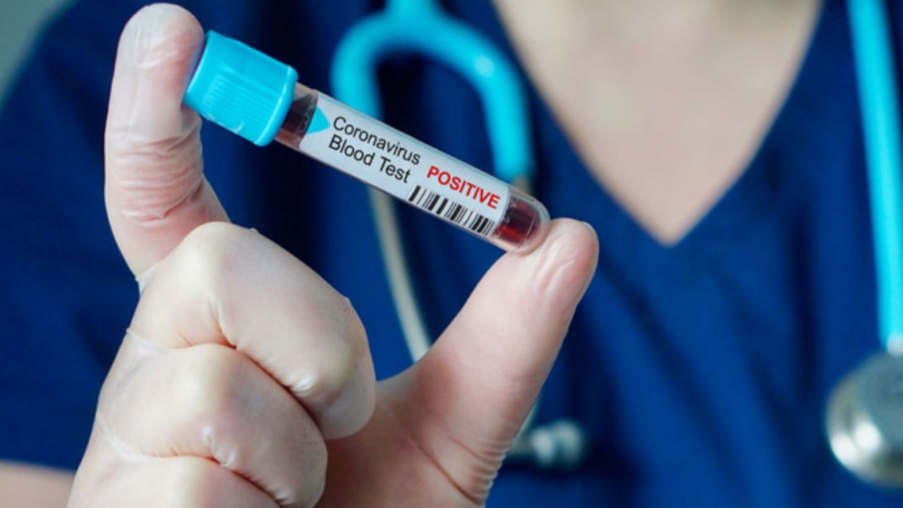 Coronavirus en México: Durango suma 7 casos positivos de Covid-19