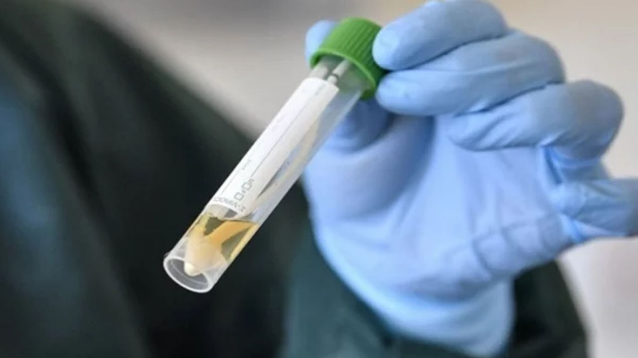 Autoridades de Sinaloa confirman dos muertes a causa de coronavirus