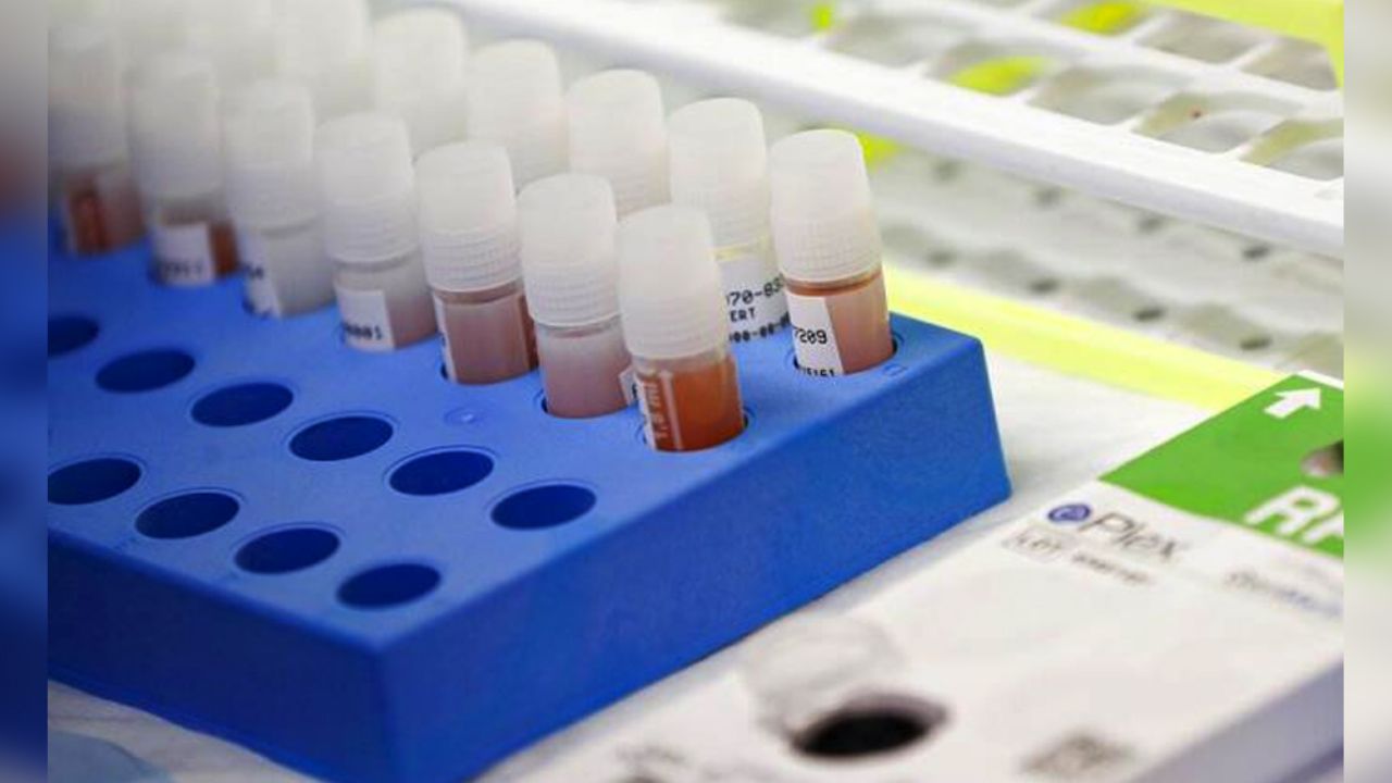 Quintana Roo confirma 42 casos positivos de coronavirus; hay un muerto