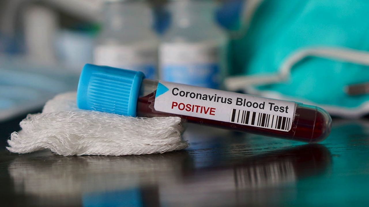 Coronavirus en México: Chihuahua confirma 11 casos positivos de Covid-19