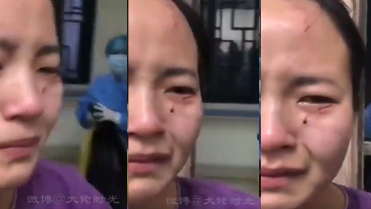 VIDEO: Paciente con Covid-19 golpea y muerde en la cara a enfermera para huir