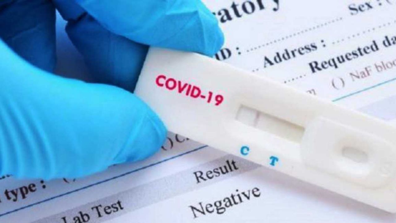 Coronavirus: Crean nueva prueba para Covid-19 que da resultados en 2 hroas