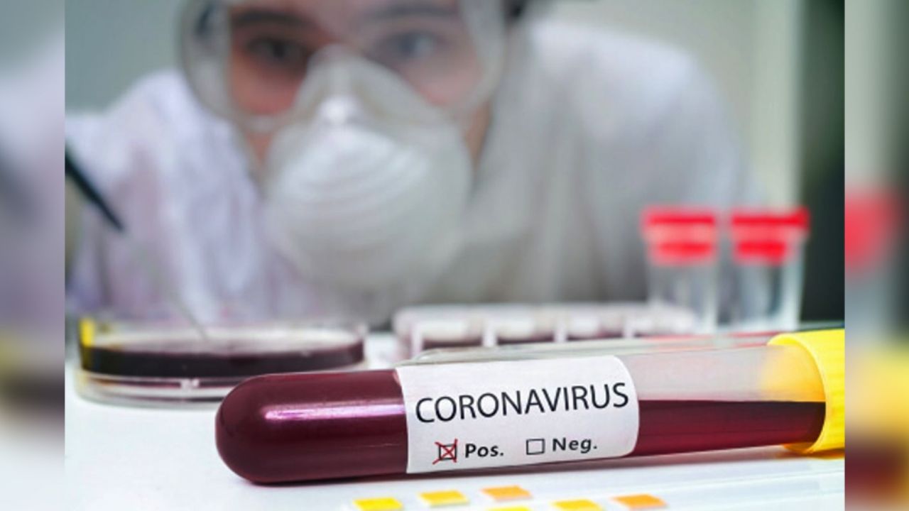 Jalisco suma dos nuevas muertes por Covid-19; hay un total de 6 fallecidos