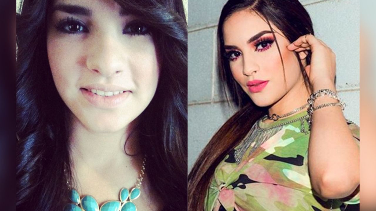 ¿Irreconocible por tanta cirugía? Viejas fotos de Kimberly Loaiza causan polémica